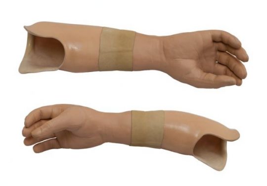 http://atelier-medical.fr/wp-content/uploads/2017/02/prothèses-membre-supérieur-Atelier-médical-strasbourg-540x377.jpg
